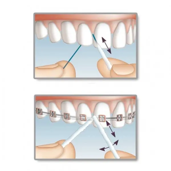 Флос Mirafloss Implant CHX Fine (1,8mm), (Miradent) — Photo 3